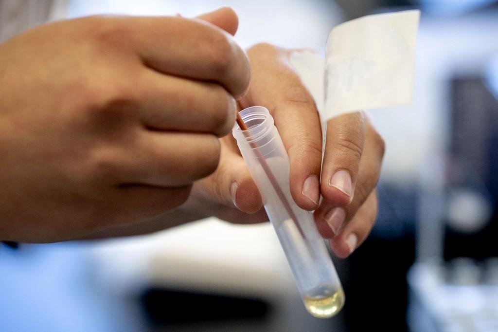 Paciente tinha 63 anos, era acreano e morava em Alagoas h&aacute; seis meses