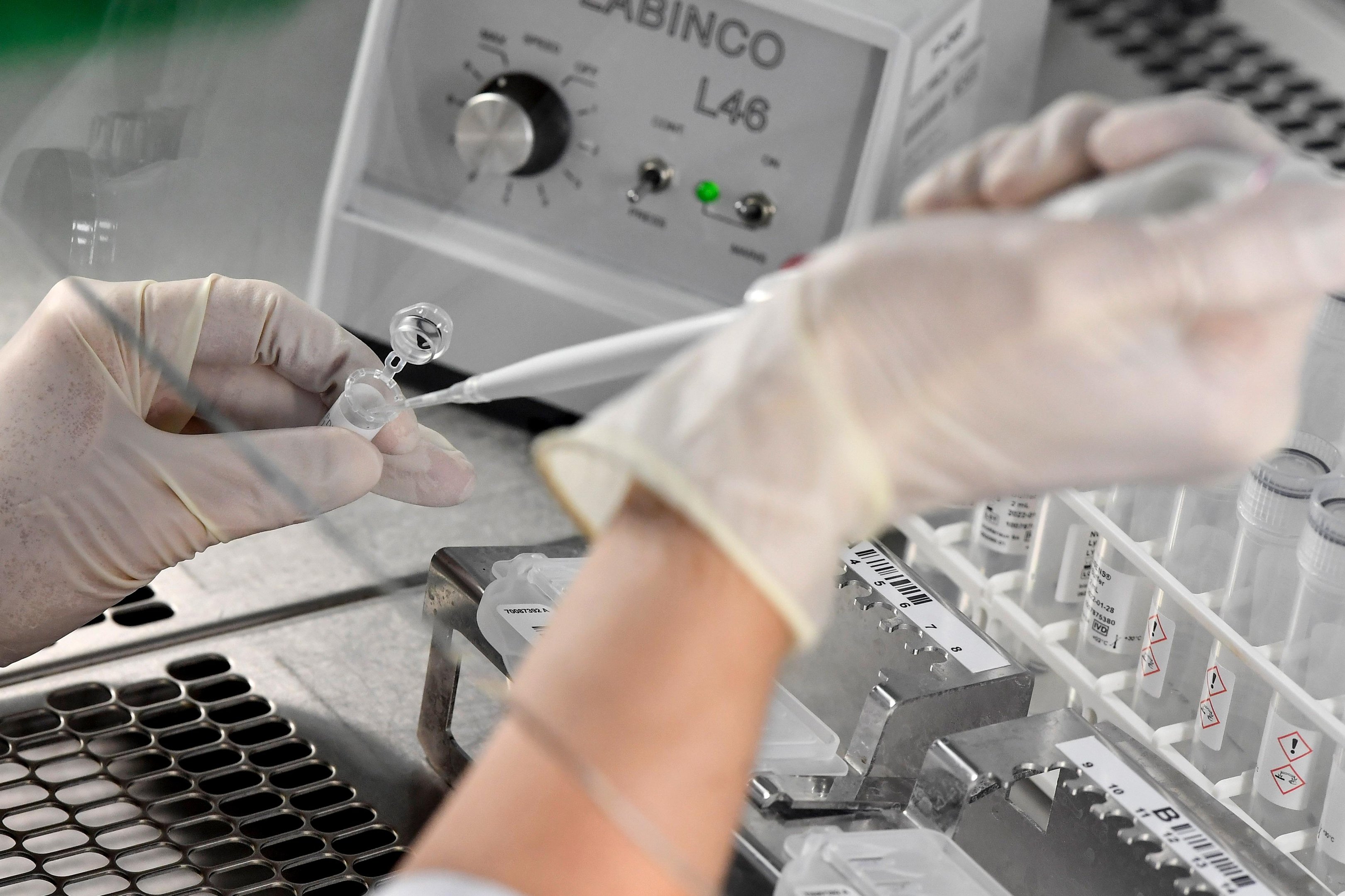 Hip&oacute;tese ainda precisa de mais estudos