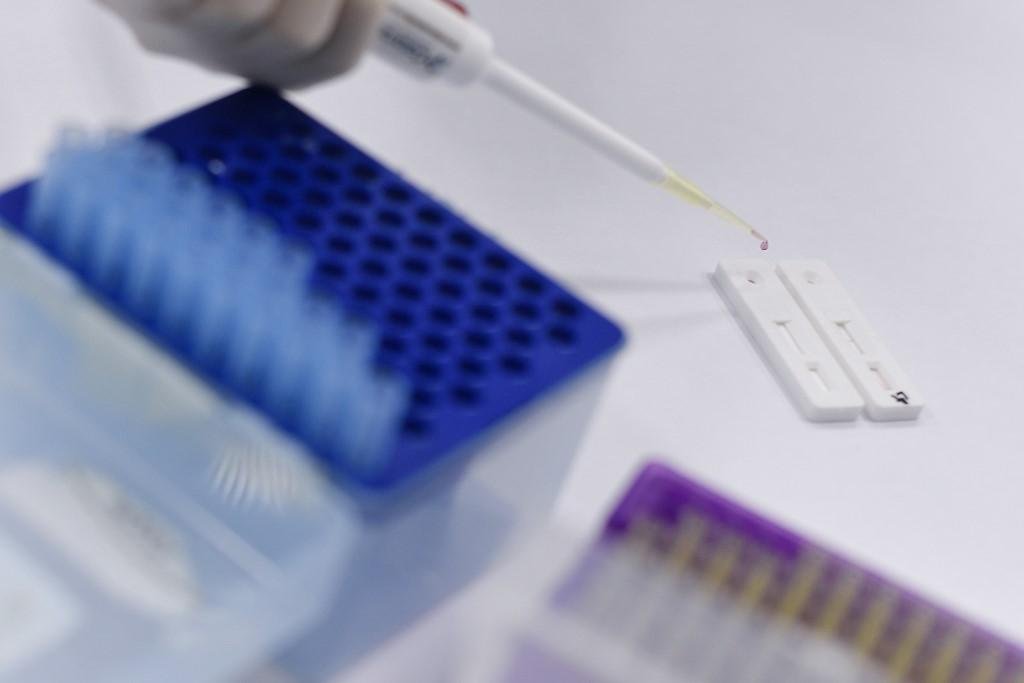 Brasil ultrapassou a marca dos 2 mil mortos em raz&atilde;o do novo coronav&iacute;rus