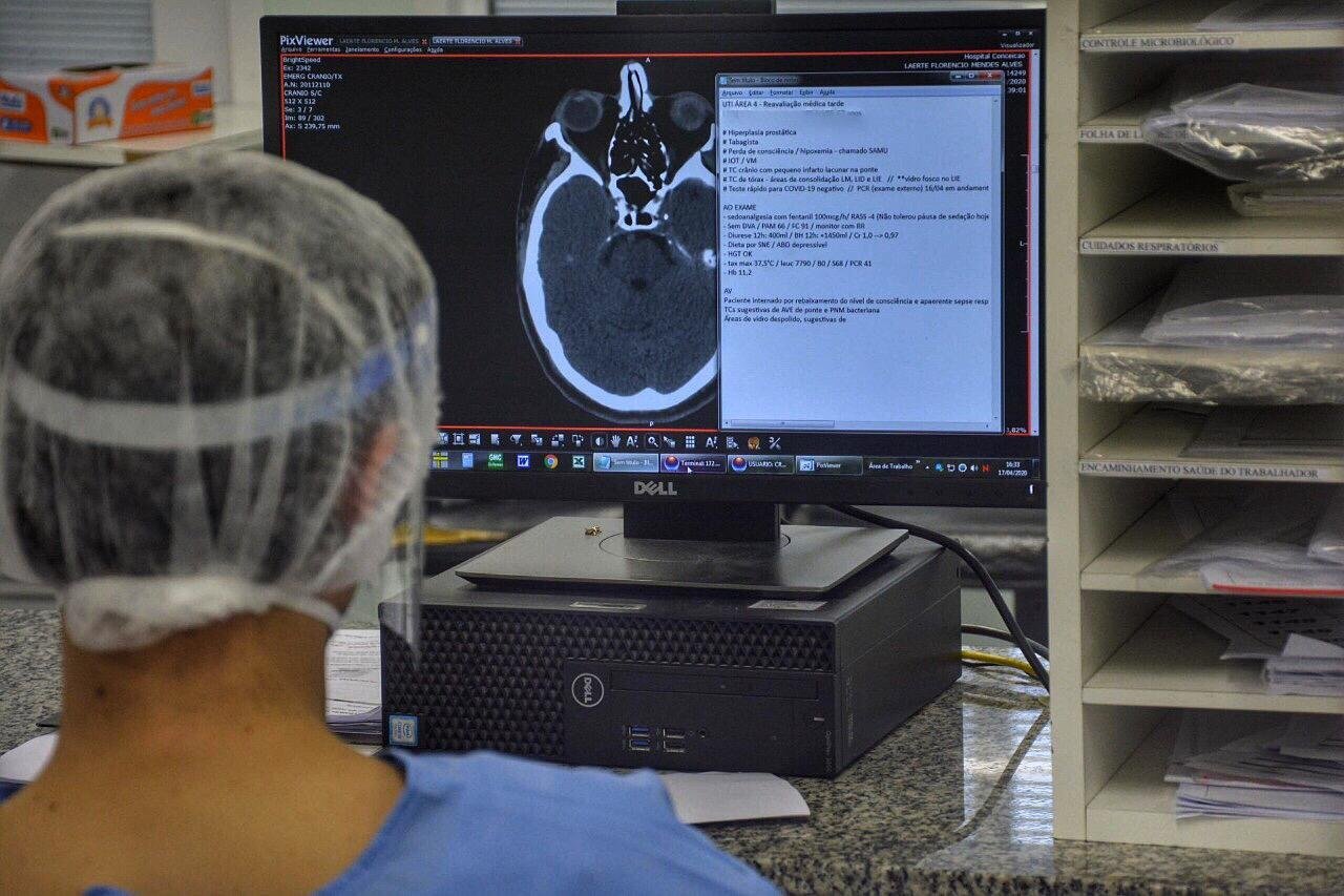 Principal teoria &eacute; que o impacto da Covid-19 no c&eacute;rebro &eacute; fruto de uma resposta imunol&oacute;gica excessiva