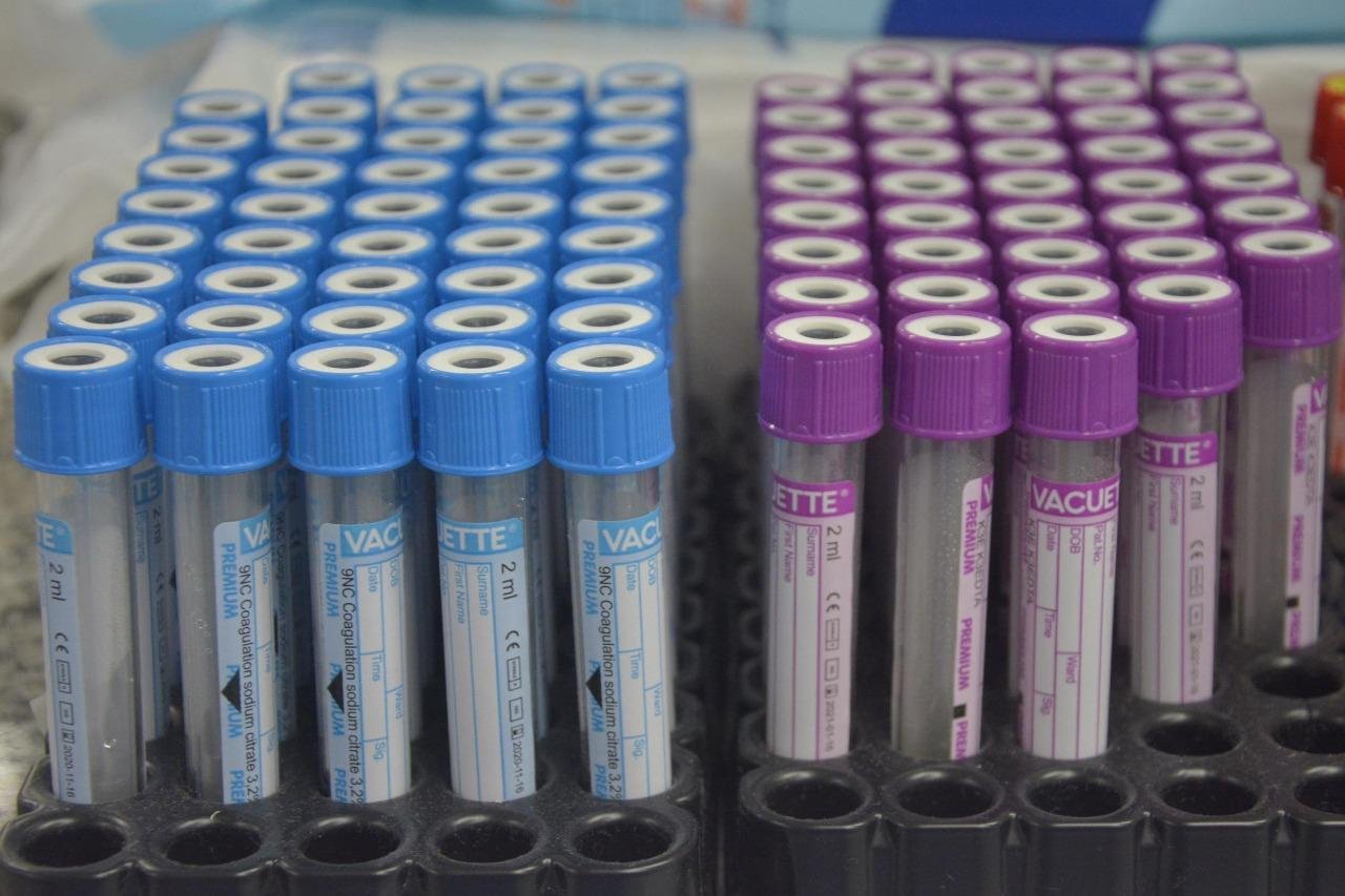 Primeiro lote com 500 mil testes, comprados pelo Minist&eacute;rio da Sa&uacute;de via Organiza&ccedil;&atilde;o Pan-Americana da Sa&uacute;de, chegou na quarta-feira ao Brasil