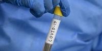 Passo Fundo registra nove mortes por coronavírus