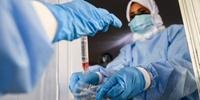 Brasil tem mais de 100 mil casos de coronavírus