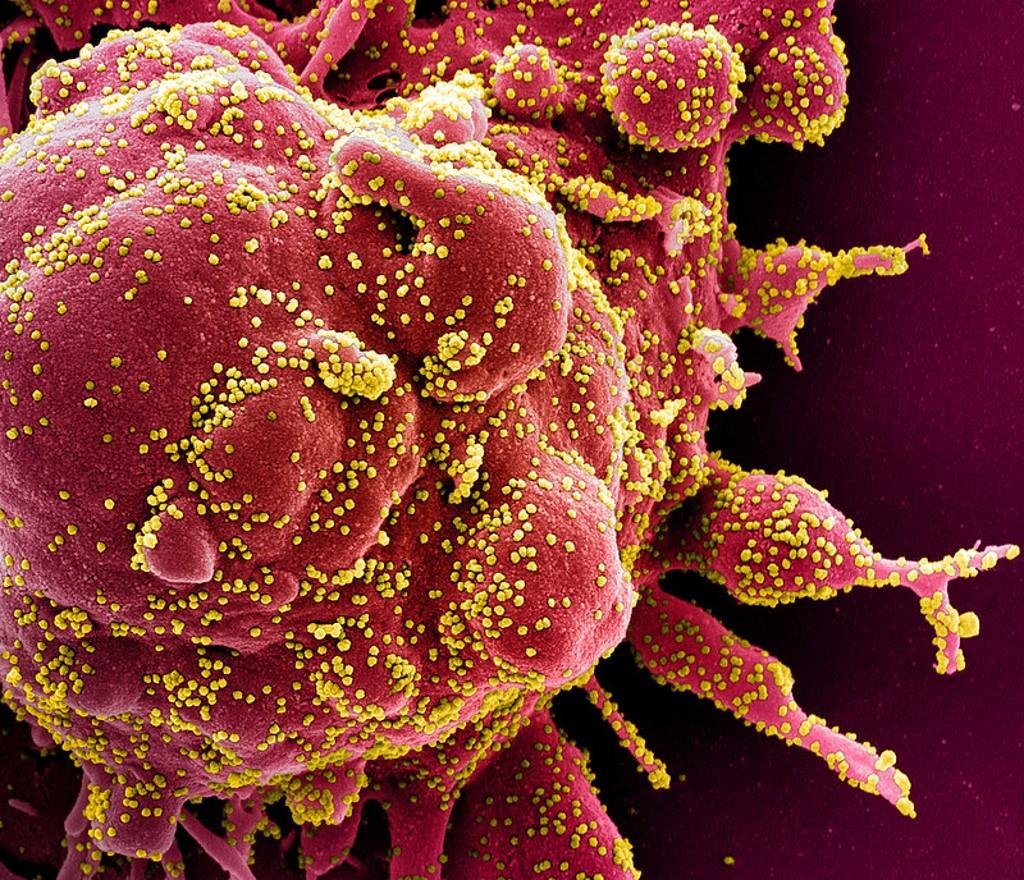 Pesquisadores holandeses confirmaram, atrav&eacute;s de pesquisa, que o intestino tamb&eacute;m &eacute; atingido pelo novo coronav&iacute;rus