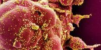 Pesquisadores holandeses confirmaram, através de pesquisa, que o intestino também é atingido pelo novo coronavírus