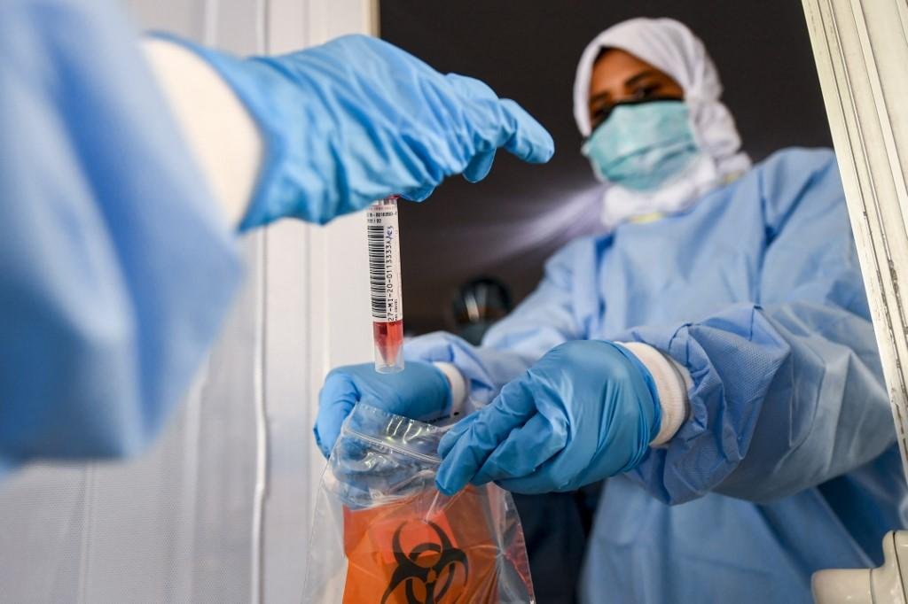 OMS considera que pacientes que voltaram a testar positivo pra Covid-19 ainda possuem c&eacute;lulas infectadas nos pulm&otilde;es