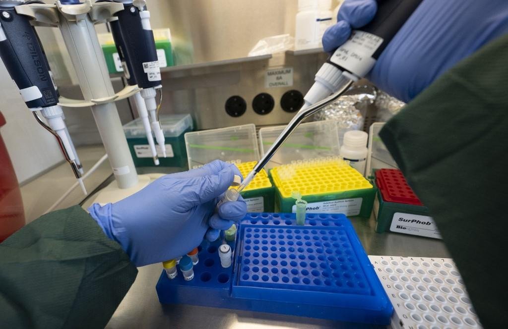 Estudo indica que infectados com Covid-19 produzem mesma quantidade de anticorpos, independentemente da idade