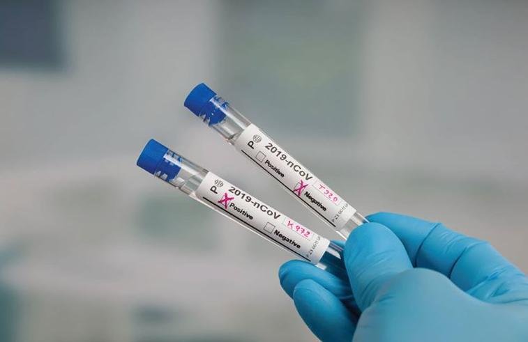 Testes foram enviados pelo Minist&eacute;rio da Sa&uacute;de e ser&atilde;o utilizados ao longo desta semana