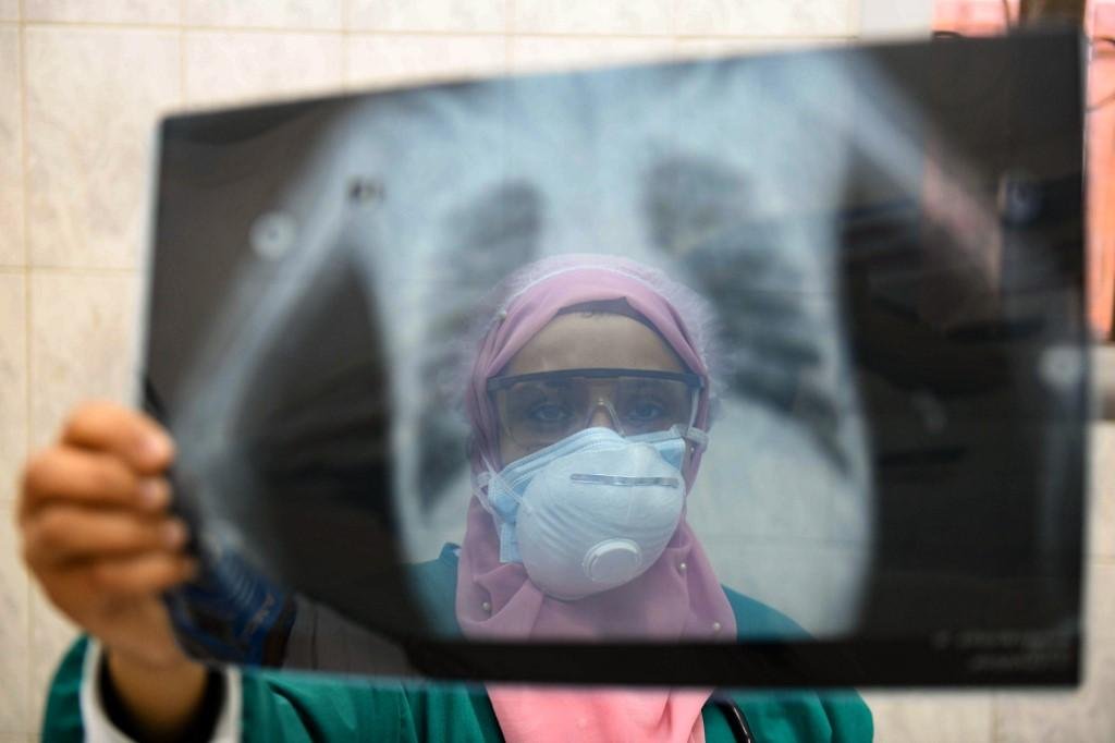 At&eacute; o momento, 7.560 pacientes j&aacute; se recuperaram da doen&ccedil;a, que atinge 302 munic&iacute;pios no Estado