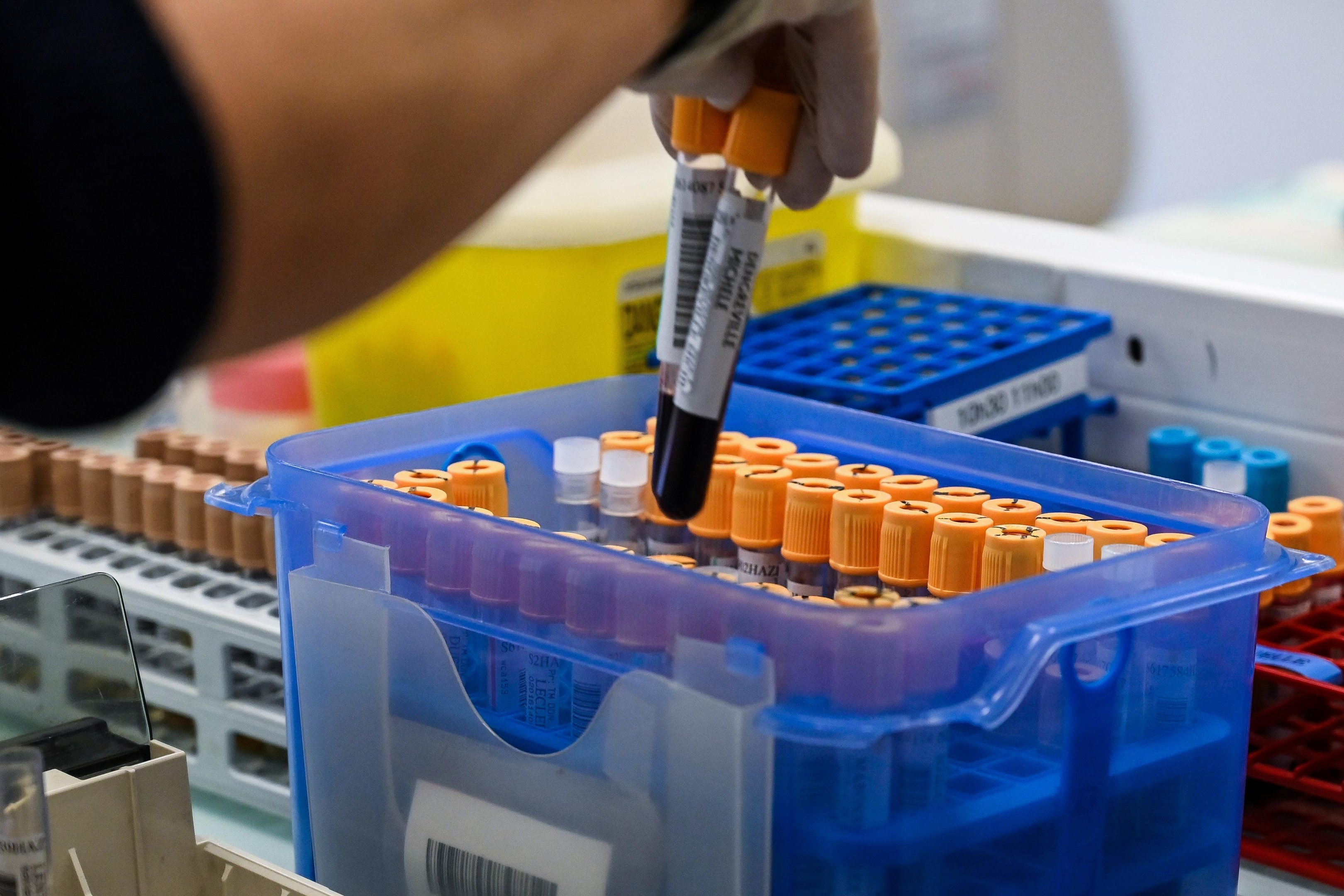 Taxa de mortalidade oficial &eacute; de 2,4%