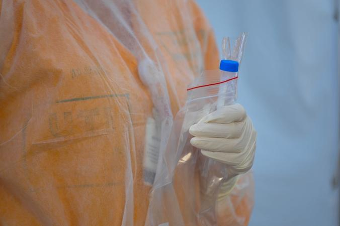 Novos casos ainda n&atilde;o foram contabilizados no boletim epidemiol&oacute;gico da SES
