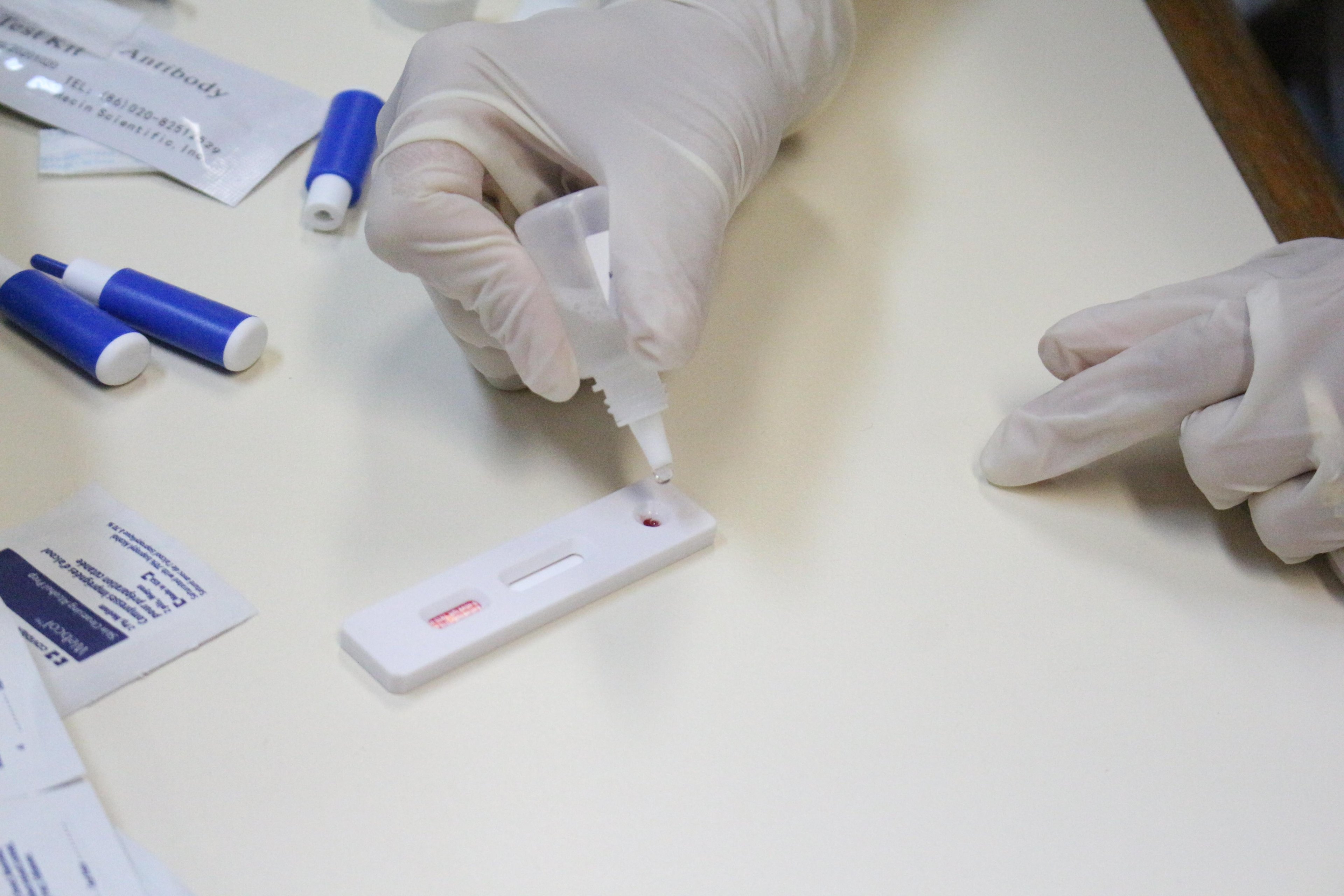 Receita Federal doa testes r&aacute;pidos