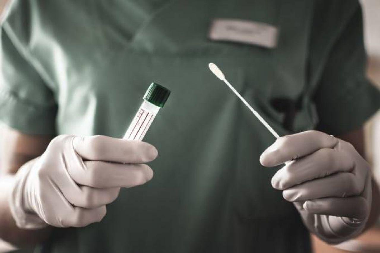 Atualmente, s&atilde;o realizados 30 testes por dia em cada unidade