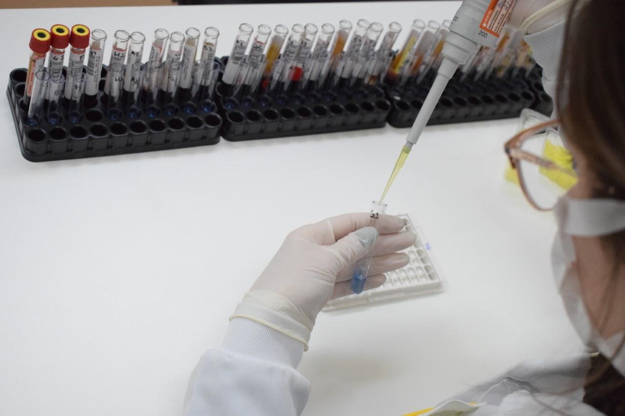 Laborat&oacute;rio de An&aacute;lises Cl&iacute;nicas do Hospital Tacchini, em Bento Gon&ccedil;alves, foi validado pelo Lacen para a realiza&ccedil;&atilde;o de exames para detectar a Covid-19