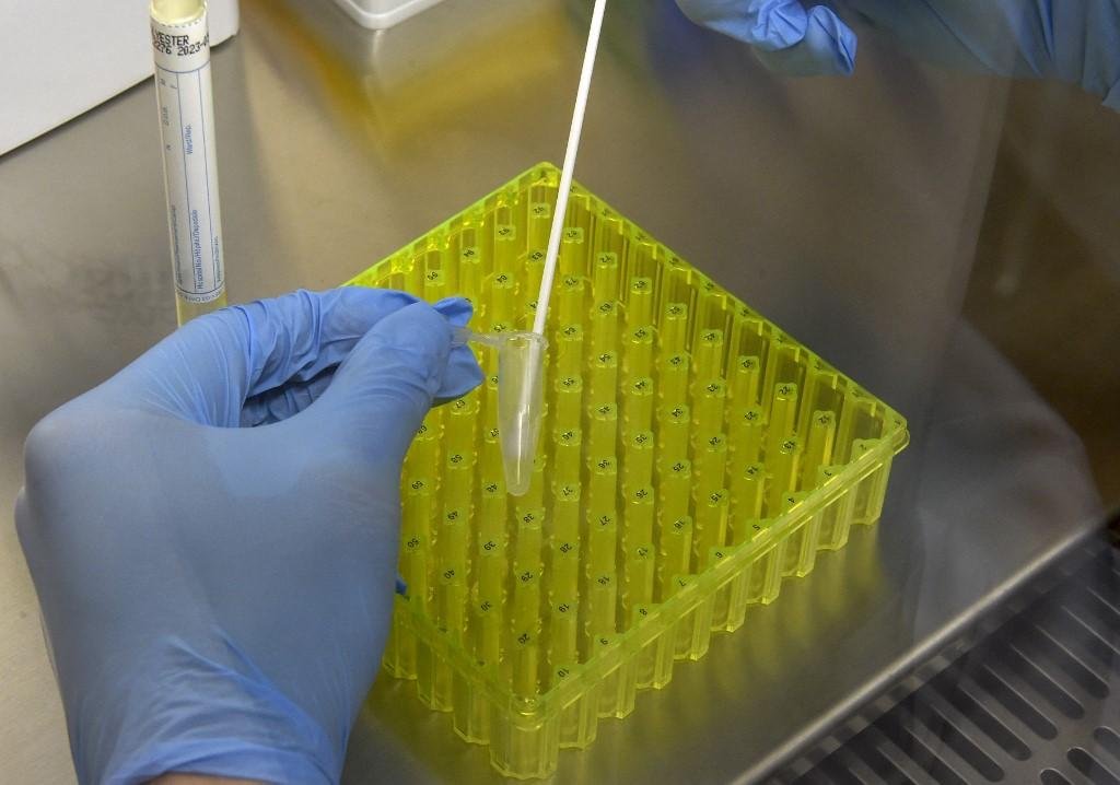 Pesquisas sugerem que o BCG tem efeitos ben&eacute;ficos na imunidade contra uma variedade de infec&ccedil;&otilde;es relacionadas ao pulm&atilde;o