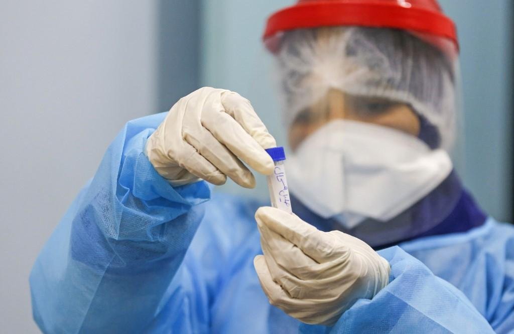 EUA ter&atilde;o 100 milh&otilde;es de doses, europeus cerca de 300 milh&otilde;es e Reino Unido, 60 milh&otilde;es