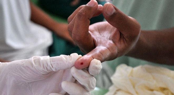 At&eacute; hoje, existe apenas tratamento para hepatite C, mas n&atilde;o cura