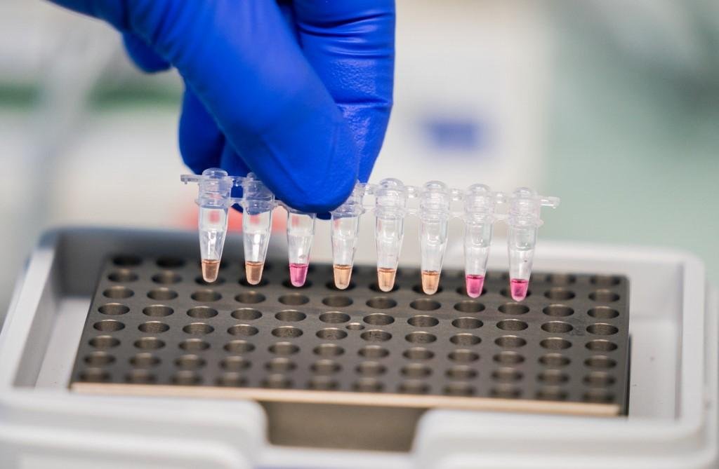 Empresa espera que os testes cl&iacute;nicos de fase 3 iniciem nos Estados Unidos e no M&eacute;xico at&eacute; o fim de novembro