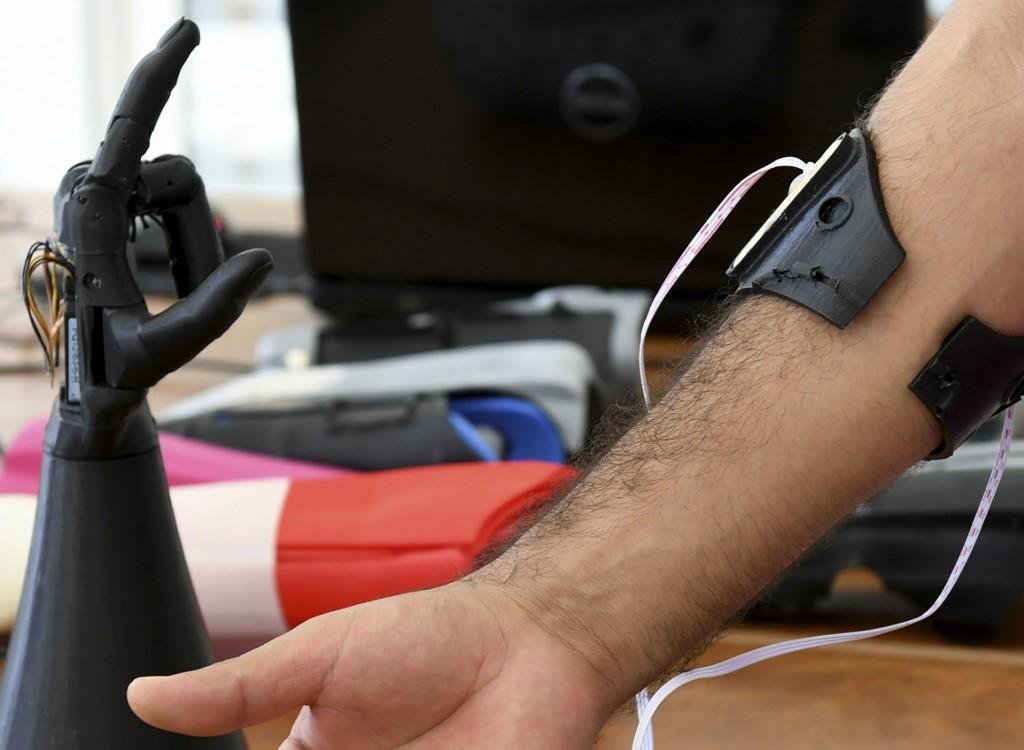 Jovens na Tun&iacute;sia criam m&atilde;o bi&ocirc;nica com pe&ccedil;as impressas em 3D