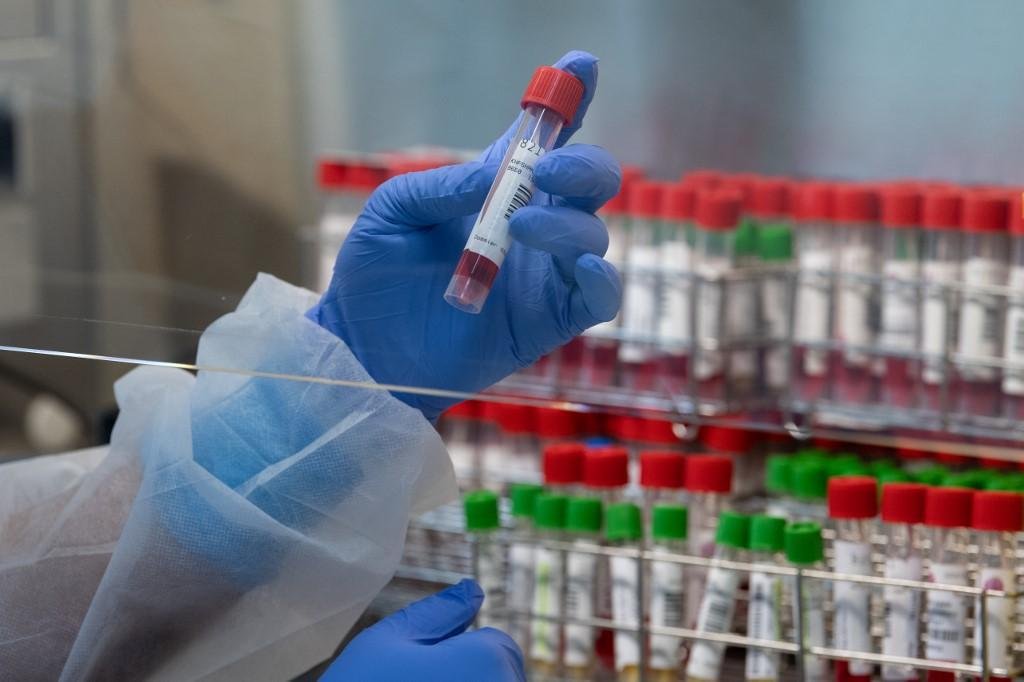 Com novos registros, Estado passa a contabilizar 6.356 &oacute;bitos por Covid-19 e 287.204 casos confirmados