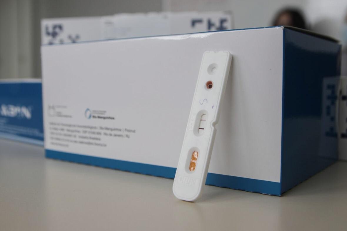 Em S&atilde;o Leopoldo, uma agenda especial far&aacute; testes r&aacute;pidos para identificar infec&ccedil;&otilde;es sexualmente transmiss&iacute;veis