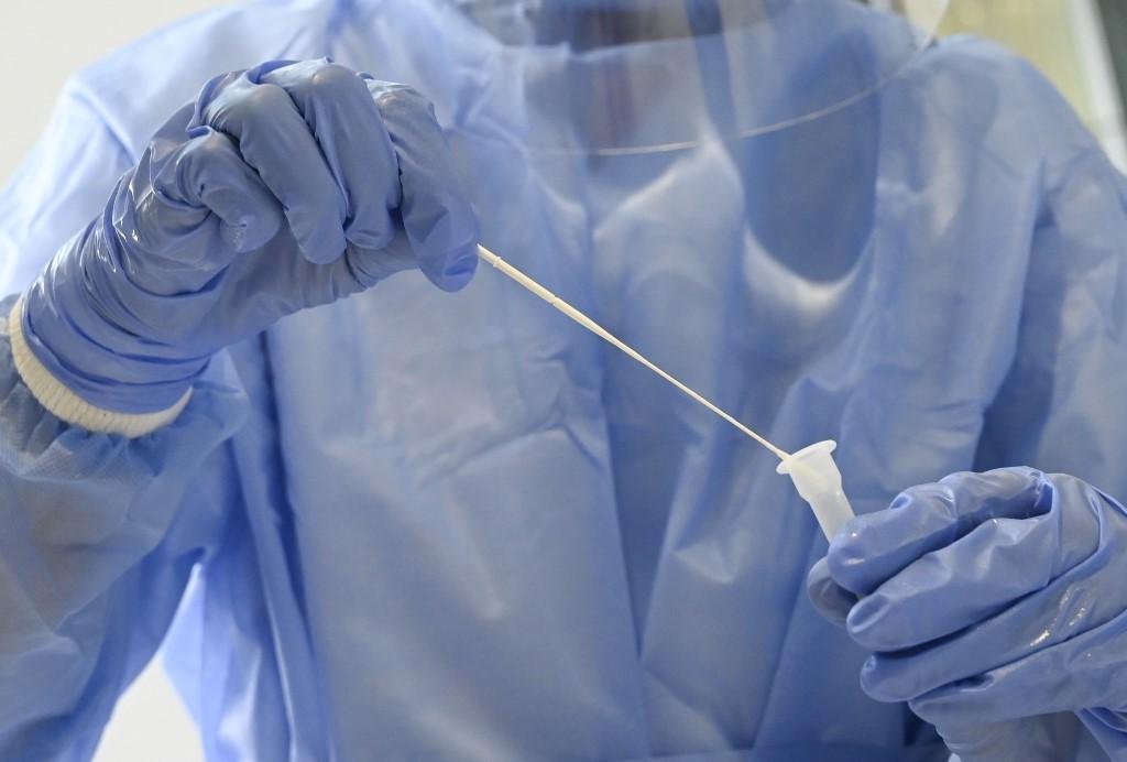 Com os novos casos, Estado passa a ter 7.587 &oacute;bitos e 376.590 contaminados pelo coronav&iacute;rus