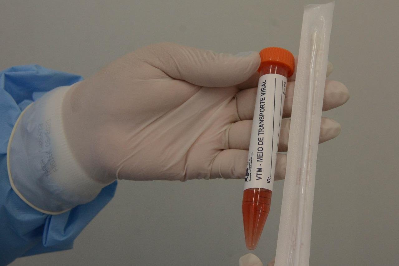 De acordo com a Pnad Covid, em outubro, o &iacute;ndice de pessoas com diagn&oacute;stico positivo para o coronav&iacute;rus era de 22,4%
