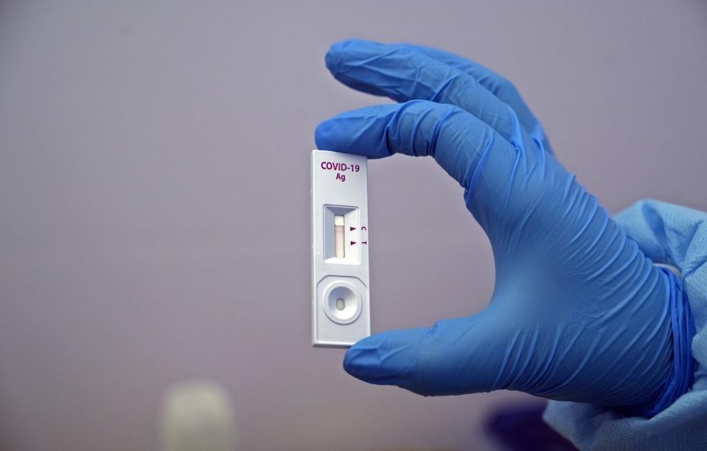 Estado contabiliza 564.709 casos confirmados em 11 meses de pandemia