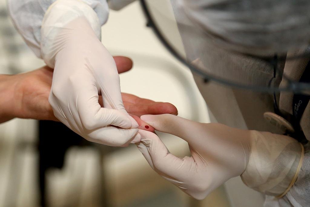Testagem na Unidade M&oacute;vel s&oacute; ser&aacute; realizada mediante o encaminhamento m&eacute;dico