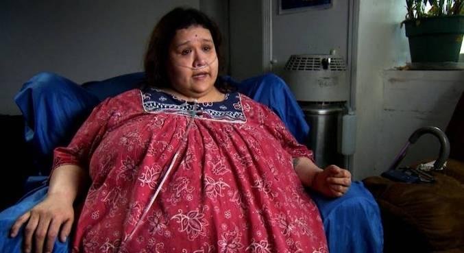 A cirurgia bari&aacute;trica foi a solu&ccedil;&atilde;o encontrada por Ol&iacute;via, que j&aacute; chegou a pesar 262 quilos