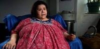 A cirurgia bariátrica foi a solução encontrada por Olívia, que já chegou a pesar 262 quilos