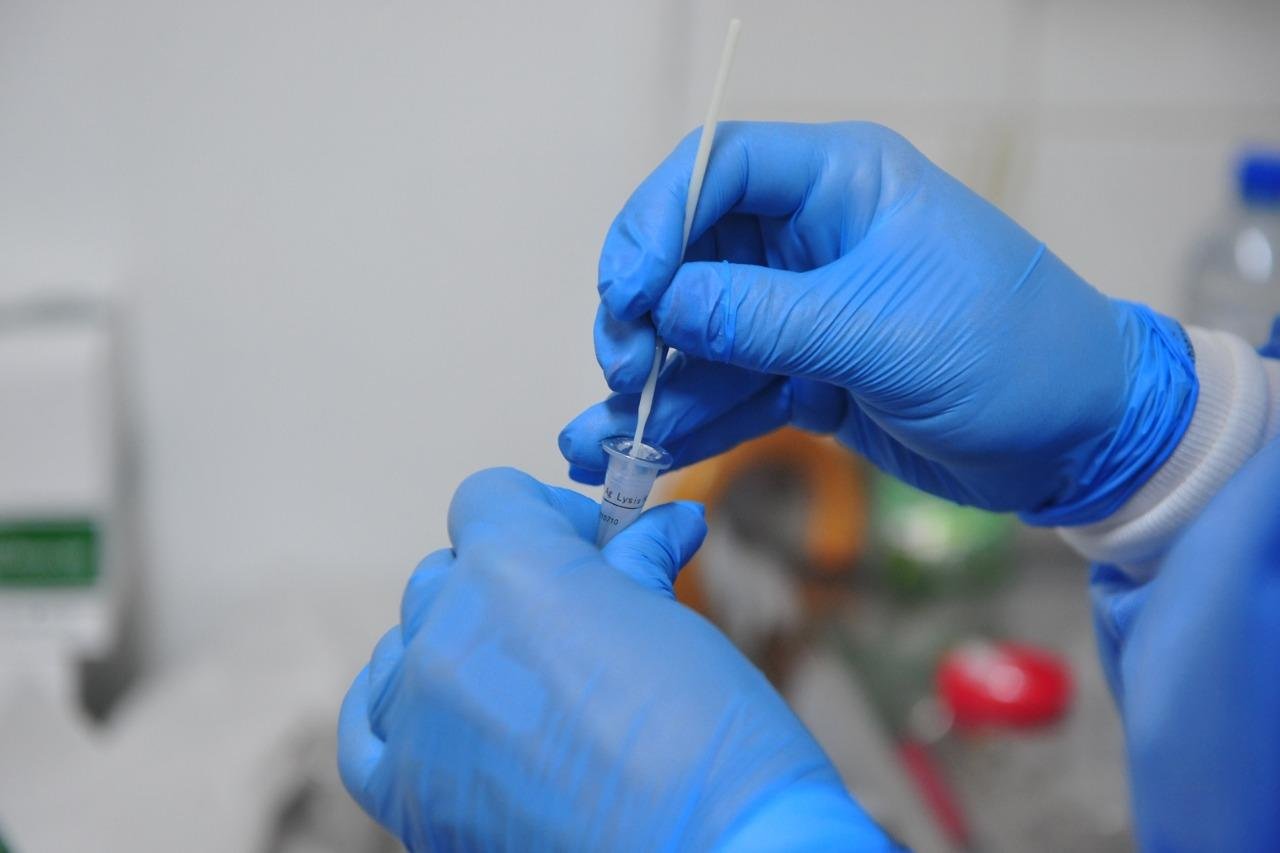 SES informou mais 22.705 novas infec&ccedil;&otilde;es por Covid-19 nesta quarta-feira