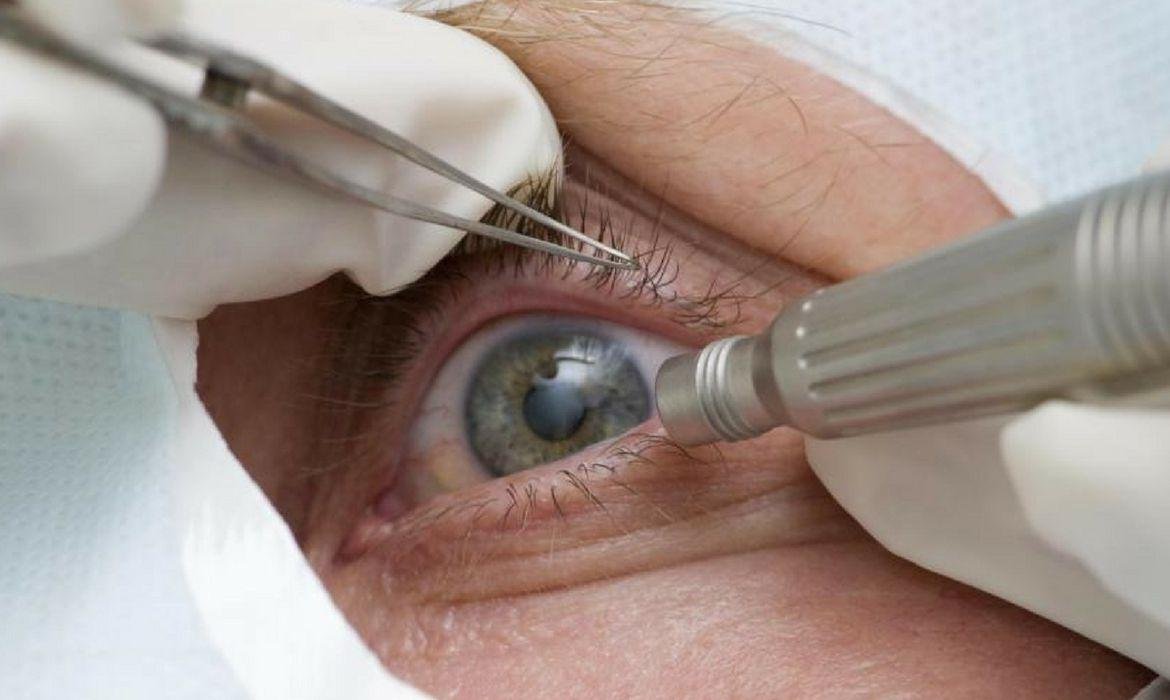 Para a Organiza&ccedil;&atilde;o Mundial da Sa&uacute;de (OMS), 80% das causas de defici&ecirc;ncia visual podem ser prevenidas ou tratadas