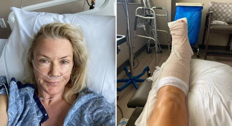 Katherine Kelly Lang quebrou o p&eacute; em tr&ecirc;s partes diferentes