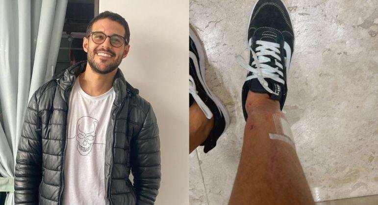 Rodrigo Mussi mostra cicatrizes na perna pela primeira vez