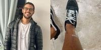 Rodrigo Mussi mostra cicatrizes na perna pela primeira vez