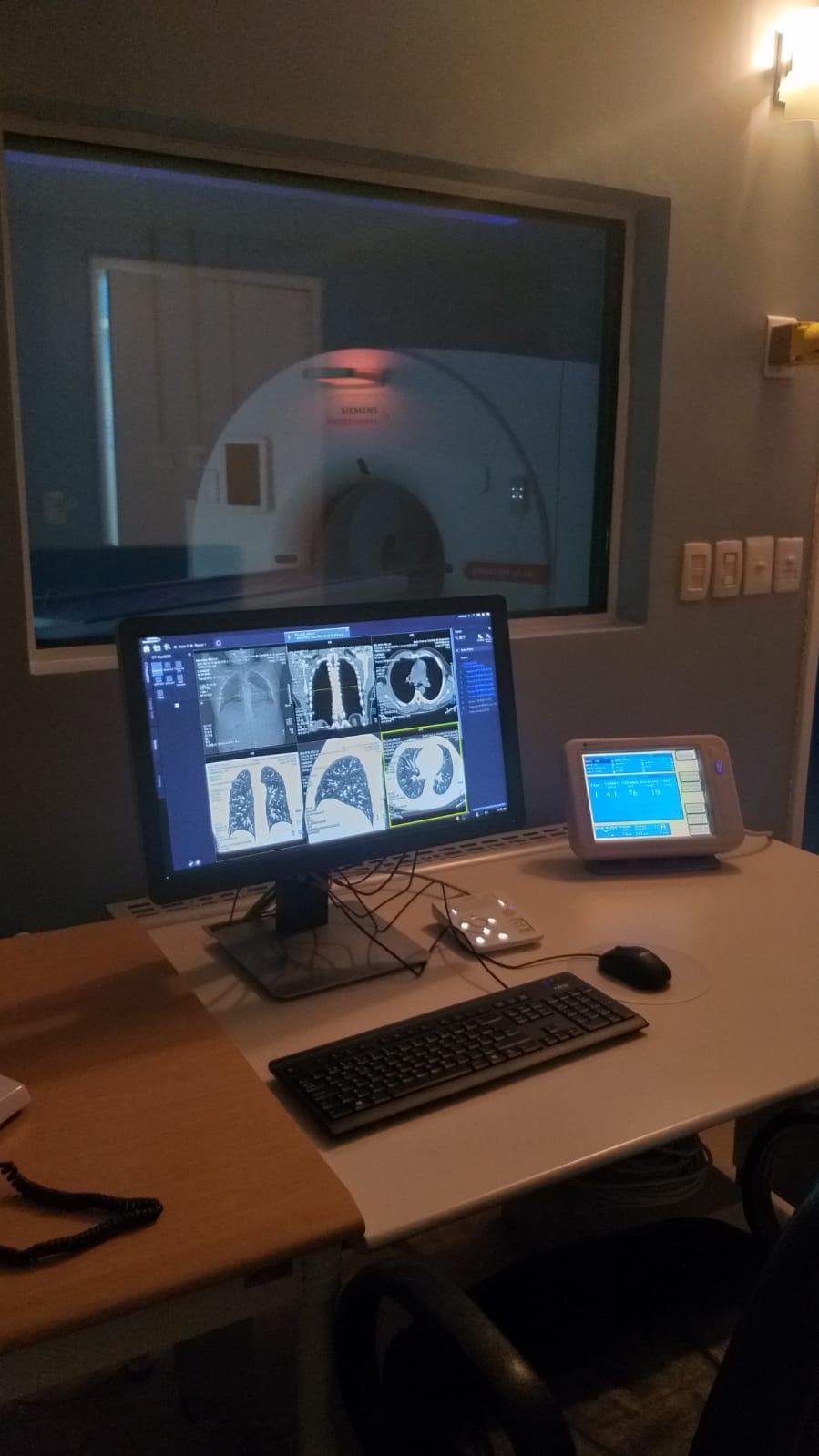 Equipamento ampliar&aacute; a capacidade de oferta de exames de tomografia computadorizada em 20%