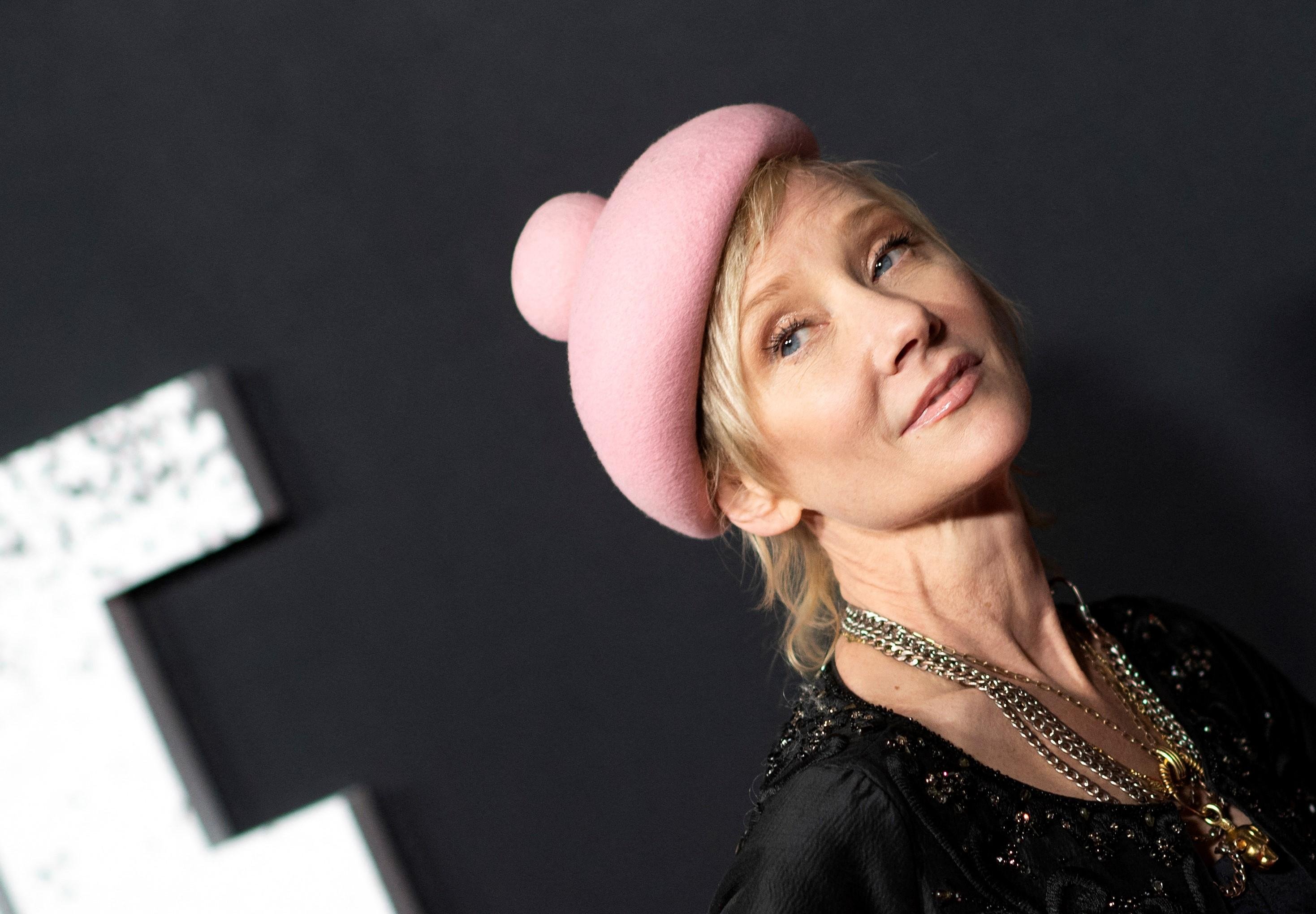 A atriz Anne Heche sofreu uma les&atilde;o cerebral