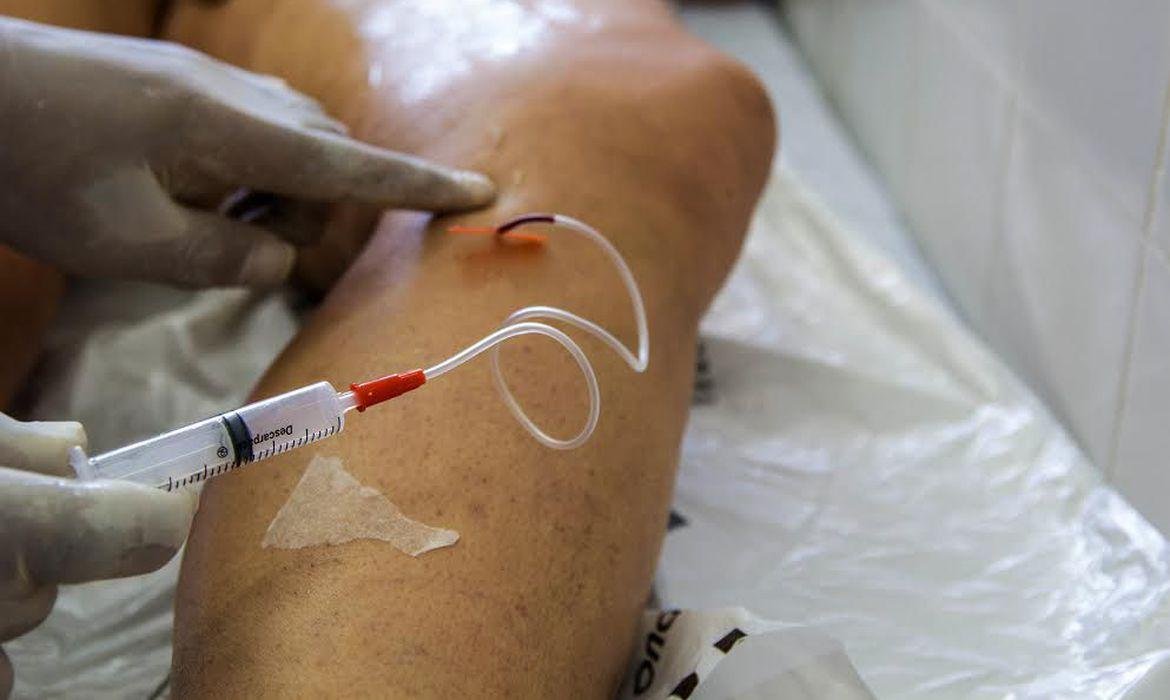 Doen&ccedil;a vascular mais prevalente, ou seja, a que mais existe na popula&ccedil;&atilde;o, &eacute; a doen&ccedil;a venosa, que s&atilde;o as varizes ou dilata&ccedil;&otilde;es de veia