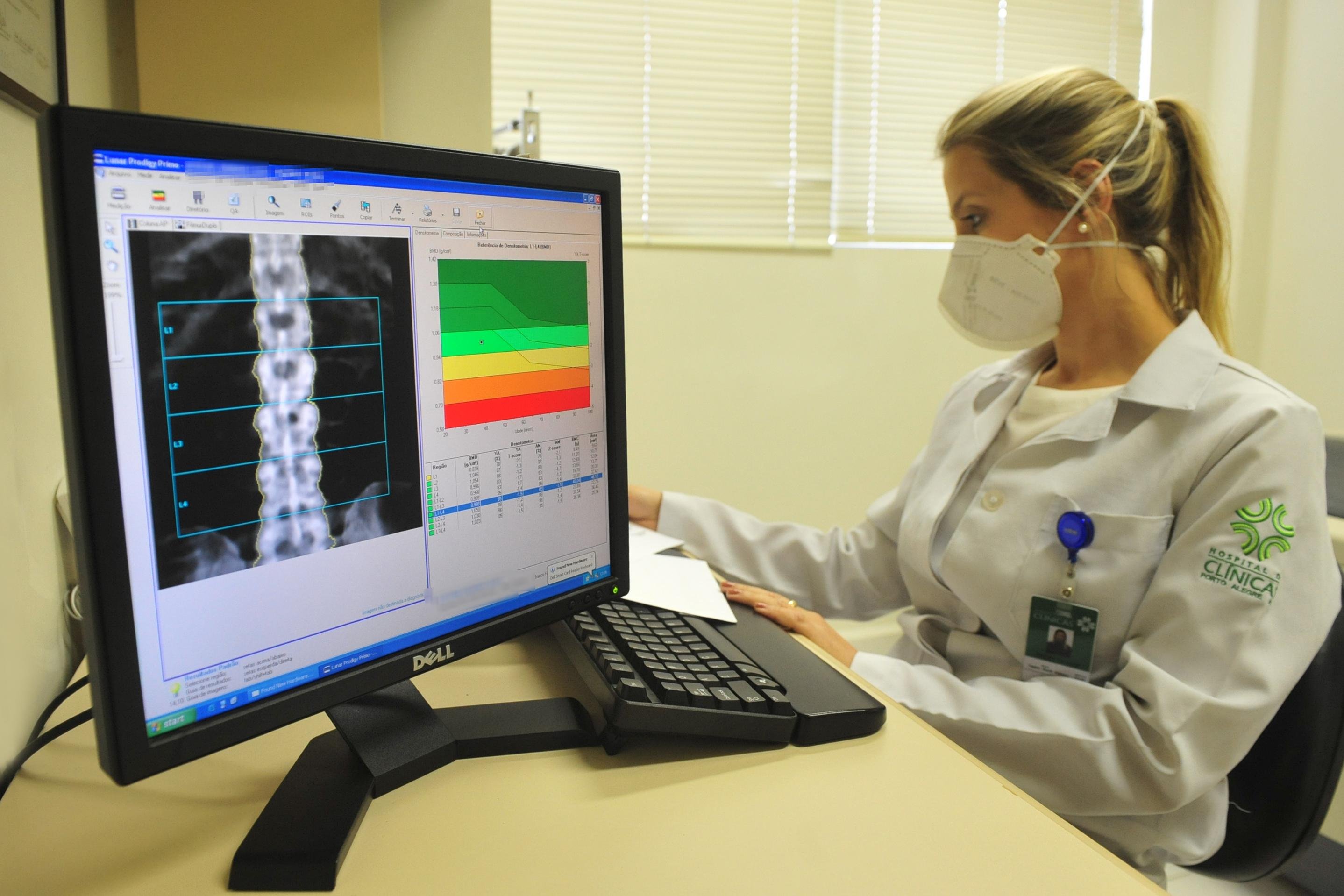 Tayane indica rastreamento da doen&ccedil;a em mulheres com mais de 65 anos ou em homens com mais de 70 anos